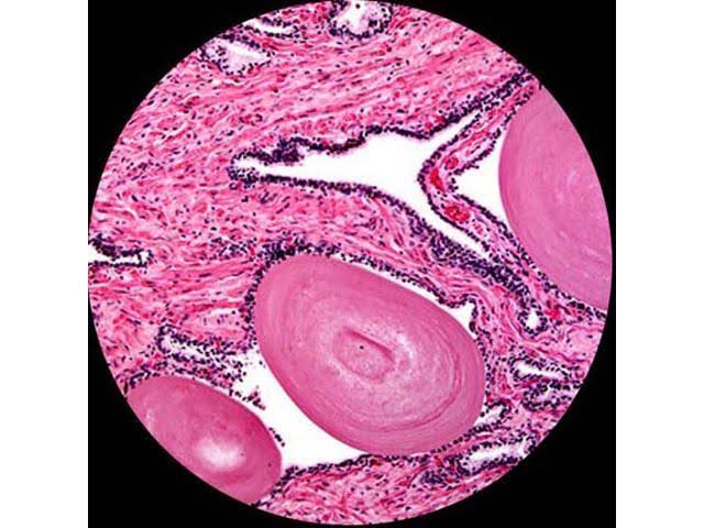 2000X LED Trinocular Compound Microscope with 3D Mechanical Stage and 9MP Camera V800